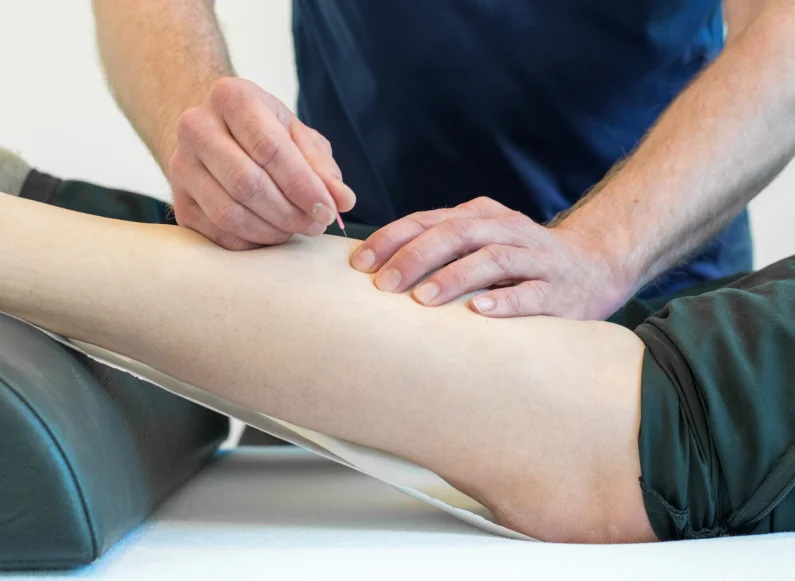 Dry Needling