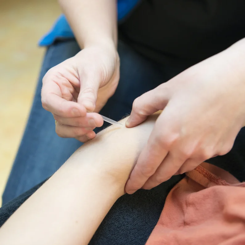 Dry Needling - Fyzie